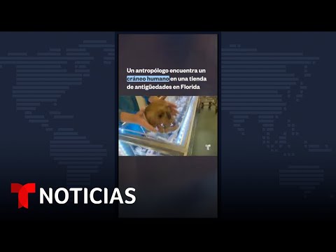 Antropólogo encuentra cráneo humano en una tienda de la Florida | Noticias Telemundo