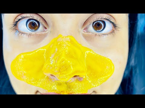 Easy way to remove blackheads and Whiteheads at home remedy | Priya Creations09 |