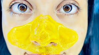 Easy way to remove blackheads and Whiteheads at home remedy | Priya Creations09 |
