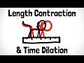 Understanding Lorentz Transformations and Their Implications