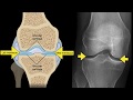 Knee Anatomy and X-ray Interpretation