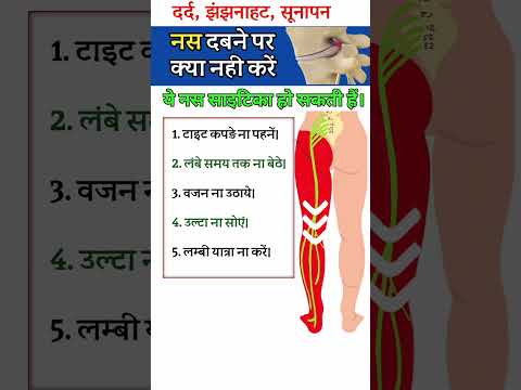 साइटिका का दर्द 😭😱🔥 #viralshorts #viralvideo #physiodrdeepaksoni #sciatica