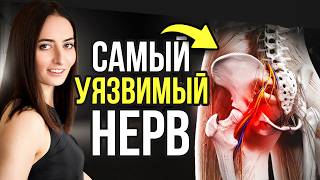 Ишиас, воспаление седалищного нерва, синдром грушевидной мышцы, слабость в ногах и онемение