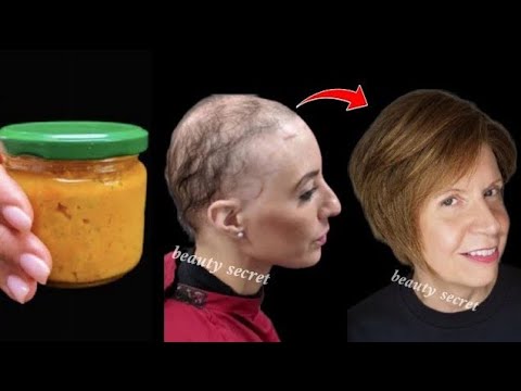 An ingredient found in every home that makes your hair grow twice as fast/treats baldness