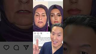 Turkish Plastic Surgeon’s Results- REAL or SUS?