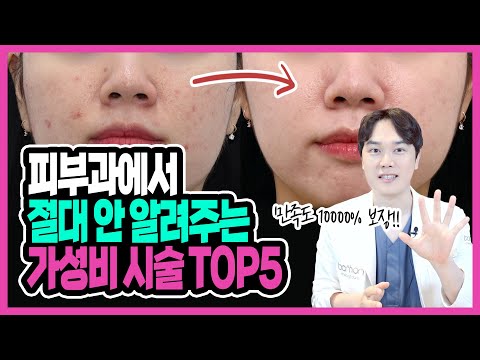 현직의사가 알려주는 찐 가성비 시술 TOP5 "피부과에서 절대 안알려주는 효과, 만족도 높은 돈아끼는 시술"