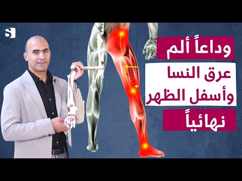 افضل فيتامين لعلاج الم عرق النسا والتهاب العصب بأفضل الطرق و بدون أدوية | اهم تمرين لعلاج عرق النسا