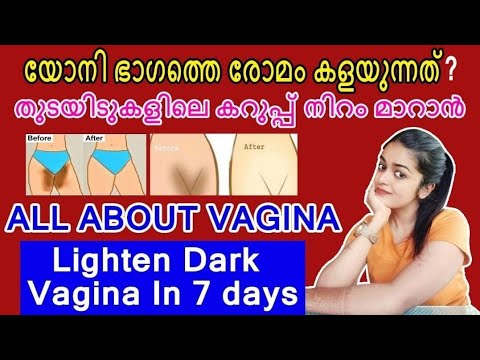 യോനി ഭാഗത്തുള്ള കറുപ്പ് യോനിയിലെ രോമം കളയുന്നത് എങ്ങനെ🙇‍♀️?|Vagina Care|തുടയിടുകളിലെ കറപ്പ് മാറ്റാം