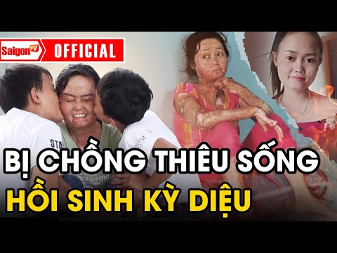 Cảm động người vợ từng bị chồng thiêu sống, 'HỒI SINH CUỘC ĐỜI' nhờ thương con vô bờ bến