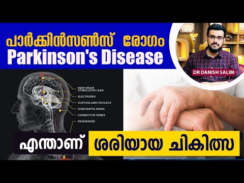 2087 : ശരീരത്തിൽ വിറയൽ, നടക്കാൻ ബുദ്ധിമുട്ട് | Parkinson's Disease