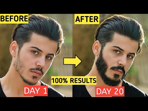 5 ULTIMATE BEARD Growth Hacks For Teenagers At Home *100% RESULTS* | Patchy Beard Solution In Hindi