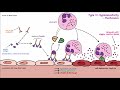 Immune Complexes and Hypersensitivity