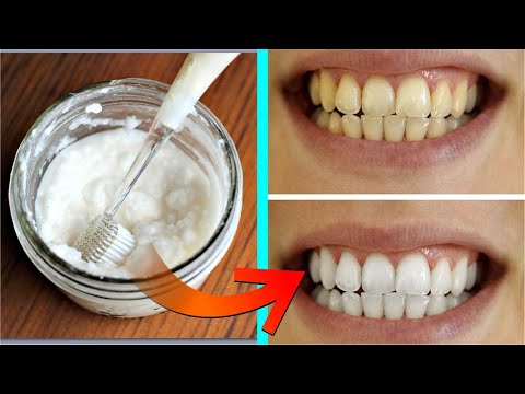 घर पर बनाएं टूथपेस्ट और काम करें दांतों का पीला पन | Homemade Toothpaste