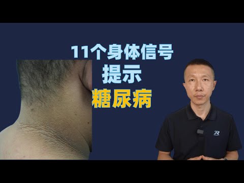 11个身体信号提示糖尿病