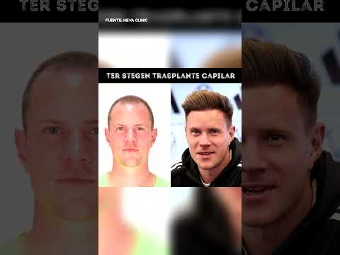 ¿SABÍAS QUE? TER STEGEN ?