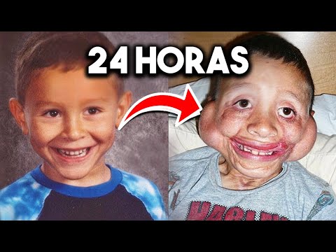 7 Personas que sobrevivieron lo IMPOSIBLE