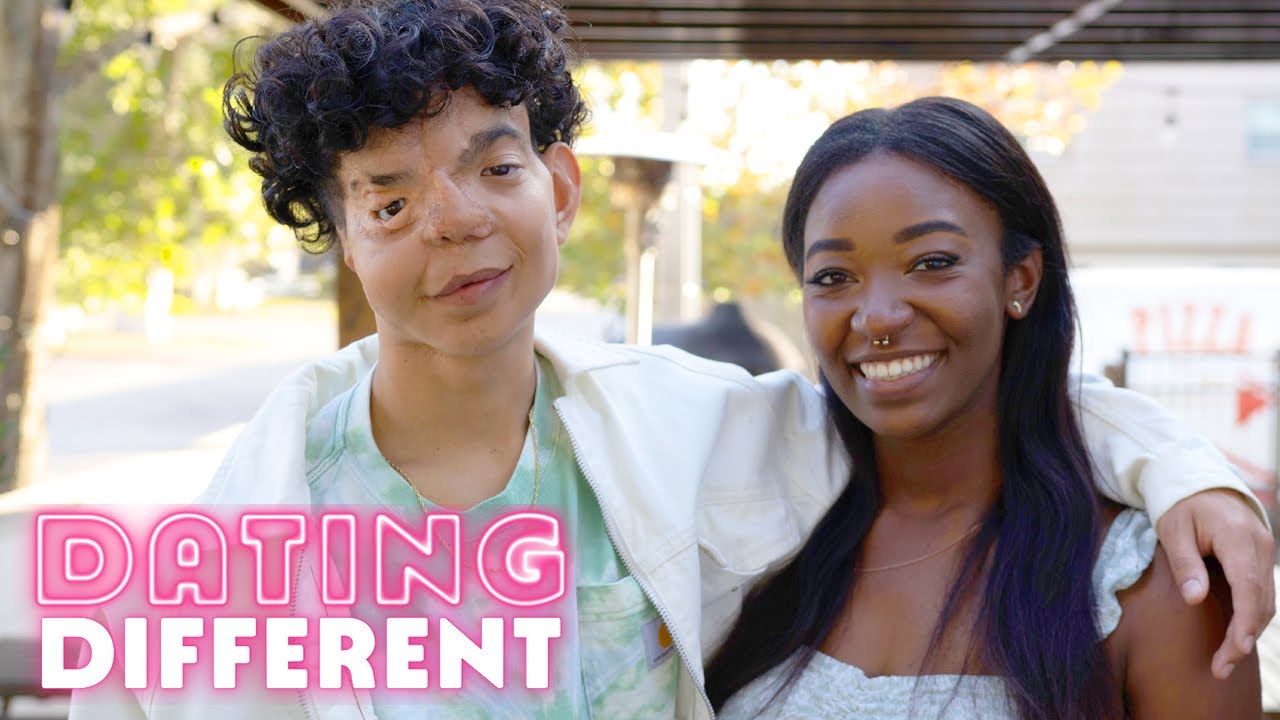 How will my blind date react to my facial difference? - dating different
