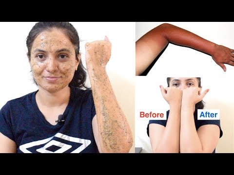 ಬಿಸಿಲಿನಿಂದ ಕಪ್ಪಾಗಿದ್ದರೆ ಮನೆ ಮದ್ದು | Sun Tan Removal From Face, Hands, Neck & Body Naturally At Home