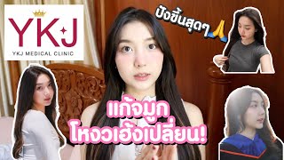 รีวิว YKJ Medical แก้จมูก2เดือน โหงวเฮ้งเปลี่ยน !! @TheerathornDrGun