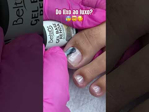 Blindagem de milhões nos Pés 🦶🏾❤️ Olha como a cliente veio! 🤯🤦🏾‍♀️ #unhasbrasil #nailcare