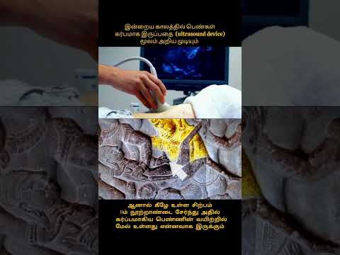 கருவில் குழந்தை வளர்ச்சி கண்டறிதல் #shorts #tamil #history