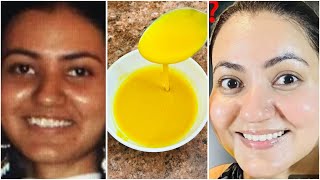 Collagen wajiga cadeynayo qurxinayo bbe face na ka dhigayo hubal🔥