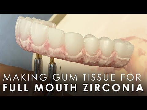 Creating the Gingiva of a Zirconia Arch