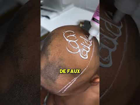 Ce Garçon Pleure a Cause de Ses Cheveux mais...