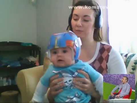 Как врачи в США выравнивают деткам голову шлемом?