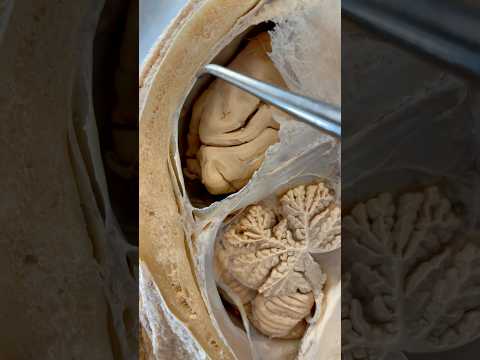 Incredible Tissue Surrounding Your Brain | Institute of Human Anatomy