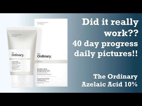 Azelaic Acid 15 Gel Coupon - 08/2021