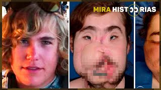 Lembra do 'MODELO' que FlCOU sem a metade do R0ST0? Ele RECEBEU UMA TRANSF0RMAÇÃ0 lNACREDlTÁVEL