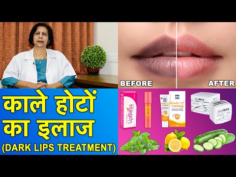काले होटों का ईलाज || Dark Lips Treatment
