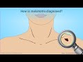Melanoma Diagnosis and Staging Concepts