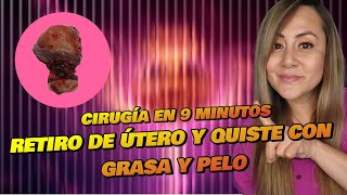 "Cirugía en 9 Minutos: Retiro de Útero y Quiste de Pelo y Grasa en Vivo 🩺✨"