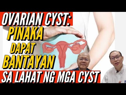 Ovarian Cyst: Pinaka Dapat Bantayan na Cyst