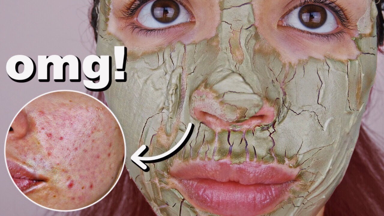 I used the aztec healing clay mask on my skin everyday for one week - Audrey Victoria