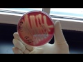 Hemolysis Types and Blood Agar