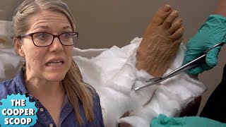 I Broke My Leg At SeaWorld Part 2 | Surgery and Recovery