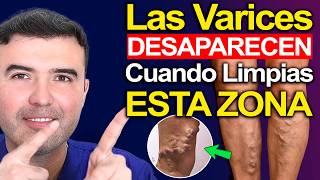 LIMPIAR ESTA ZONA Elimina Varices y MEJORA TU CIRCULACION Para Siempre Siempre!