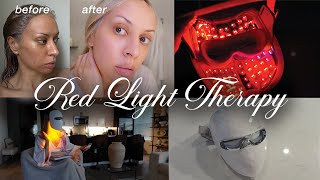 This Red Light Therapy Mask Replaced My $500 Facials!!! Ulike Reglow Review