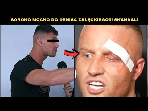 SZOK! SOROKO BEZLITOŚNIE DO DENISA ZAŁĘCKIEGO!