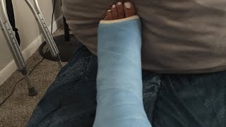 Broken Ankle Info + Meds & Narcotics