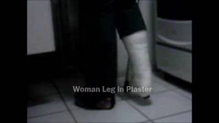 Slwc plaster leg