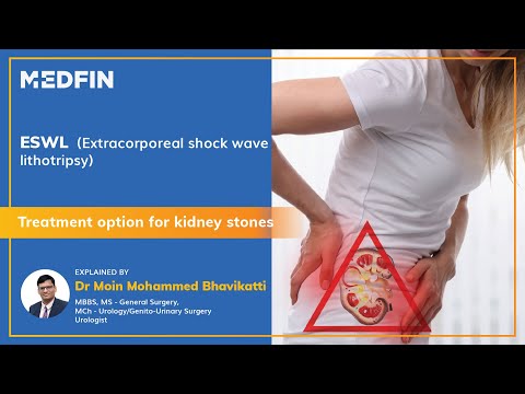 ESWL (Extracorporeal Shock Wave Lithotripsy) Surgery for Kidney stones explained