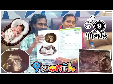 9 month baby growth scan /murugannisha #murugannisha #baby #pregnancy #babygrowth #9monthbaby #love