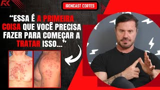 COMO TRATAR OS EFEITOS COLATERAIS DE USO DOS ESTEROIDES? (TESTOSTERONA) – IRONCAST CORTES
