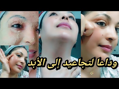 داومي على هذه الوصفة ومساج يومي أقسم لك ستخلصك من تجاعيد الوجه كأنك في20من عمرك مجربة ومضمونة 💯