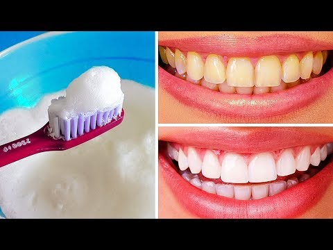 おうちですぐ！黄ばんだ歯を白くする１０の方法