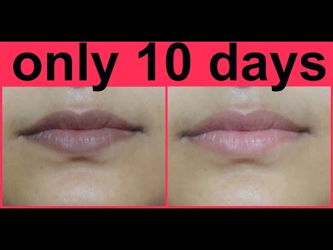 Remove Darkness From Lips Forever | Lighten Your Lips Naturally In 10 Days